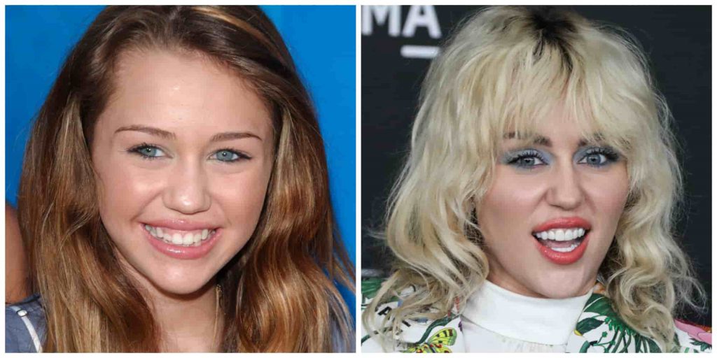 Are Miley Cyrus’ Teeth Real or Fake? | Longevita